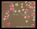 e.coli, salmonella colonies